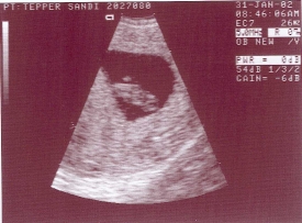 Baby at 7 wk 4 days